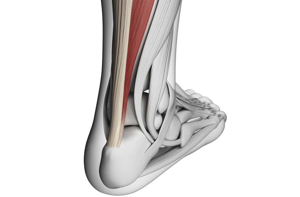 Heel pain after hot sale achilles rupture